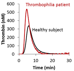 thrombosis_Romy